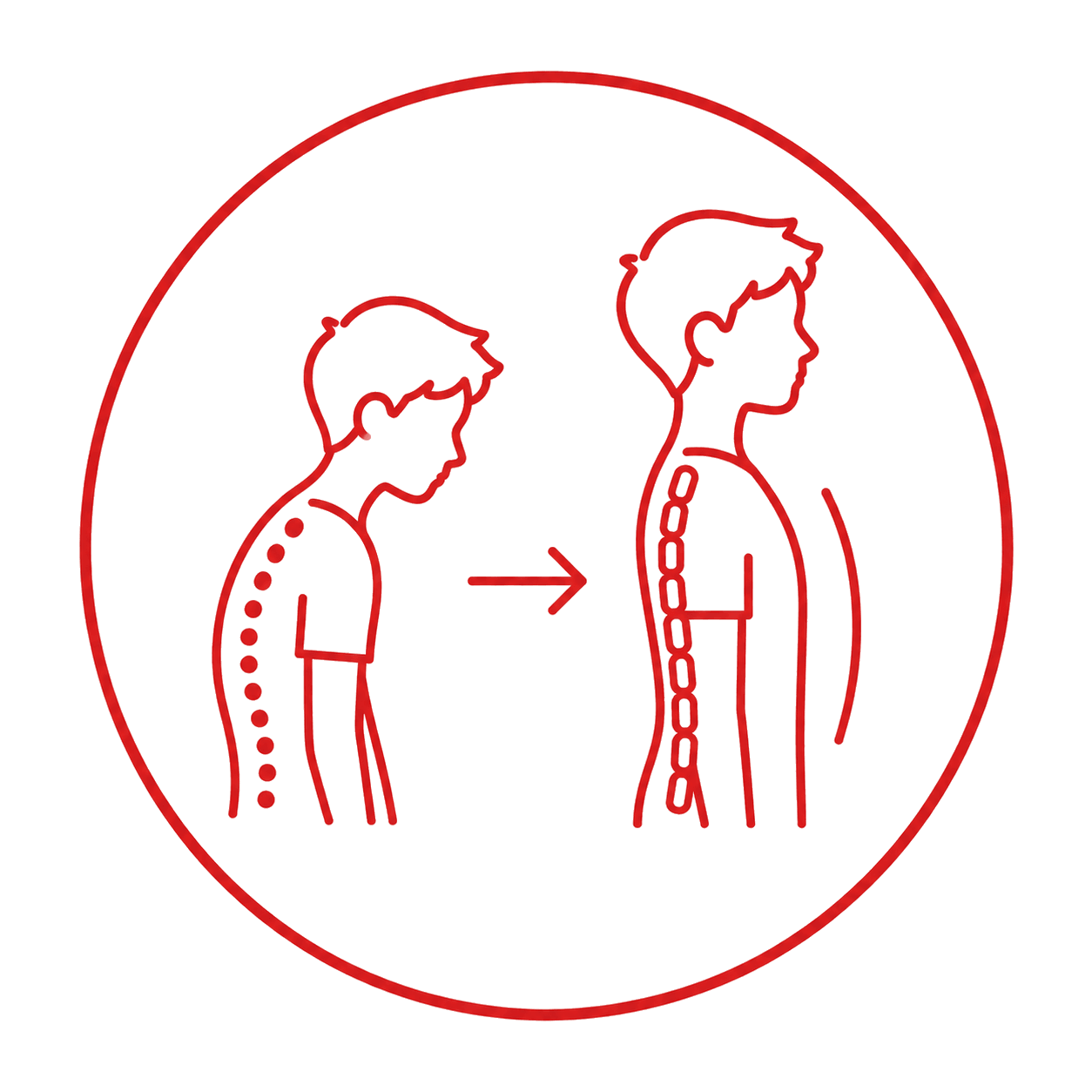 Adolescents needing posture correction